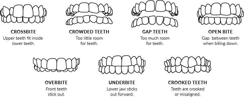 Invisalign Smile Assessment, Boundary Trails Dental Centre | Morden, Manitoba